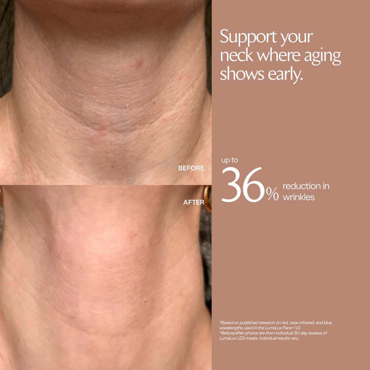 Testimonianza LumaLux Face+ V2 con foto del collo prima e dopo e una percentuale di studio