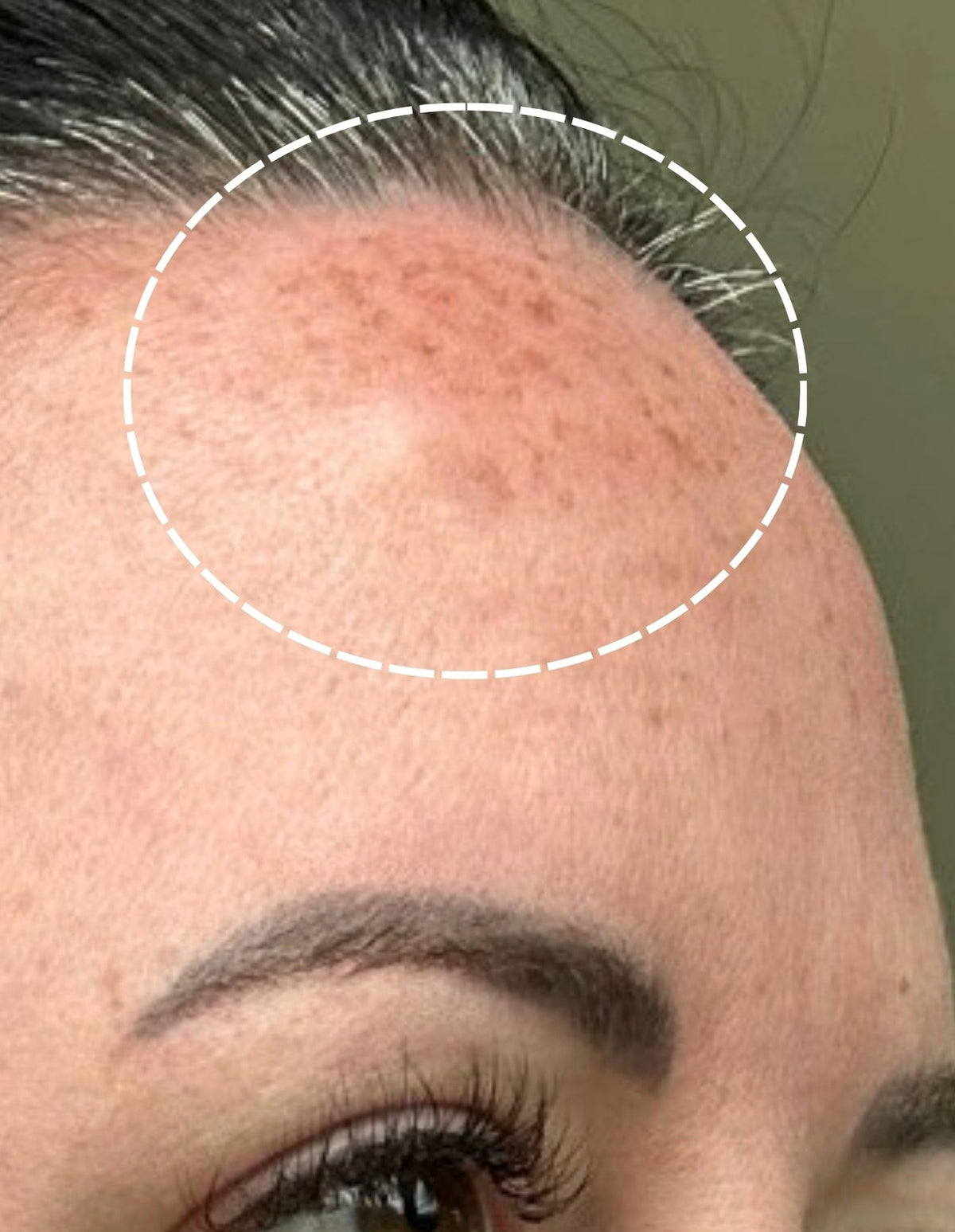Sheri before using LumaLux Face